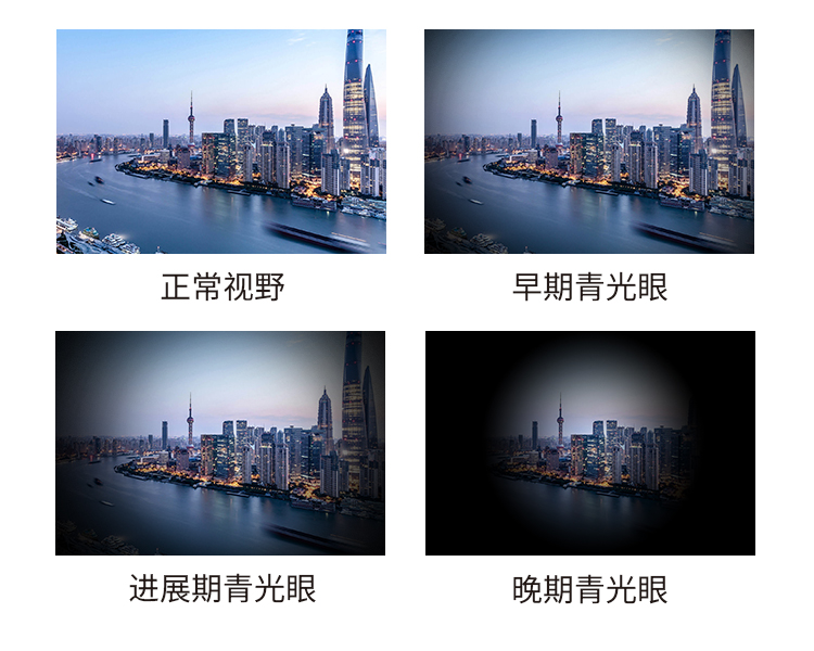 青光眼進(jìn)展圖片.jpg