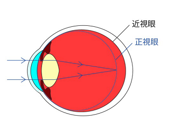 愛眼日如期而至，關注孩子眼睛健康，讓他們擁有一個光明未來！