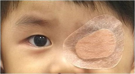 孩子看東西老喜歡斜著眼，“打一頓”就能好嗎？