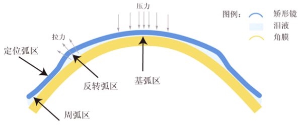怕孩子度數猛增？除了開啟APP青少年模式，還有一招可控制！