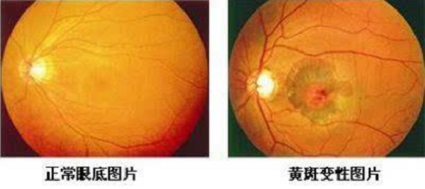這個夏天對眼部防曬還沒重視起來?小心這4種病癥找上你!